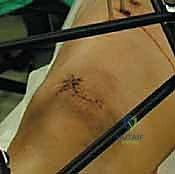 صورة شعاعية تؤكد الرد المبدئي