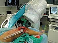 حفر مسار المسامير