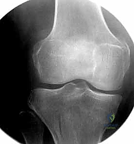 فريق طبي متكامل بقيادة د. هطيف