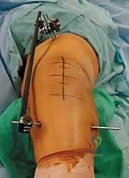 التأكد من التثبيت الميكانيكي