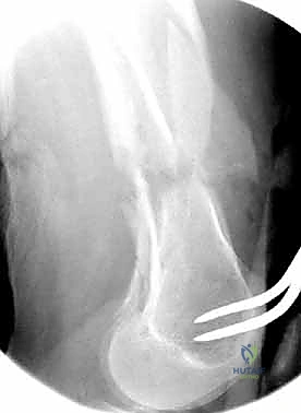 استخدام تقنيات متقدمة في الجراحة