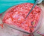 التشريح العظمي لمنطقة الركبة