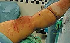 تجهيز المريض في غرفة العمليات