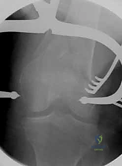 الإغلاق التجميلي للجلد