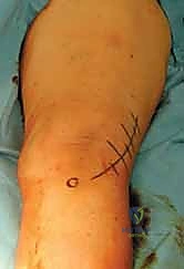 التأكد من حرية حركة المفصل