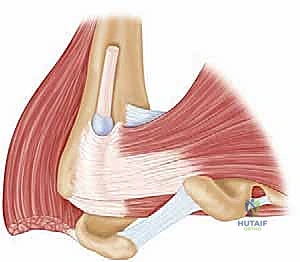 التشريح الدقيق وتحديد العضلة الصدرية الكبرى أثناء الجراحة