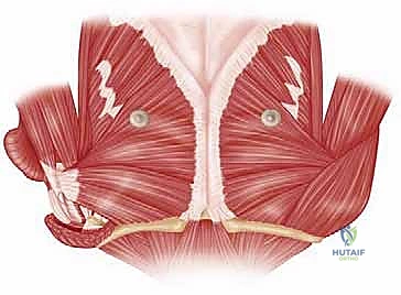 Illustration of pectoralis major transfer - Dr. Mohammed Hutaif