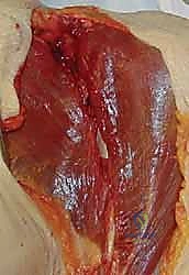 تمرير الخيوط وتحديد مسار الوتر المنقول