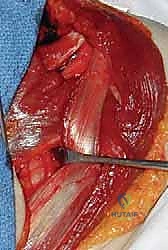التأكد من قوة التثبيت والشد المناسب للوتر