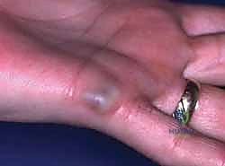 تجهيز المريض في غرفة العمليات