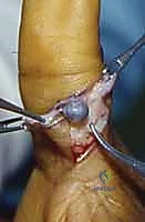 خيارات العلاج التحفظي والجراحي