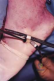 الأستاذ الدكتور محمد هطيف - رائد جراحة العظام في اليمن