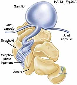 الدكتور محمد هطيف أثناء الفحص السريري الدقيق
