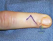 تشريح اليد والأعصاب الدقيقة