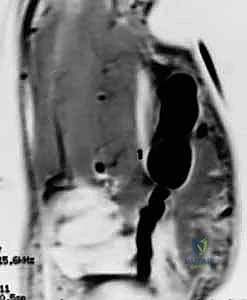 تقنيات جراحة اليد المتقدمة في صنعاء