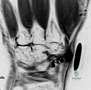 دقة شاشات العرض الجراحية