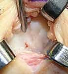 تقييم الأضرار الناتجة عن الإصابات السابقة