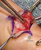 مقارنة الخيارات العلاجية مع المريض