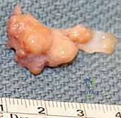 الفحص السريري الدقيق في عيادة الدكتور هطيف