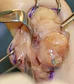 استخدام منظار المعصم 4K