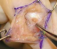 فحص الأعراض العصبية في اليد