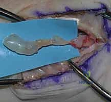 توضيح مسار الأعصاب الطرفية