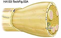 أسباب وعوامل خطر أورام الأعصاب