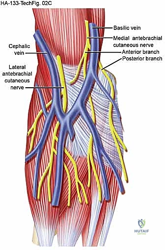 التشخيص الإشعاعي لأورام الأعصاب