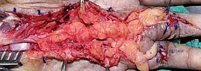 استخدام التقنيات الحديثة في الجراحة