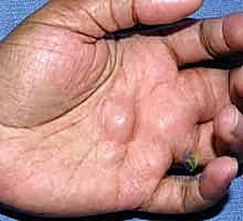 التخطيط الجراحي الميكروسكوبي