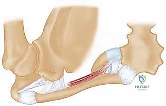 صورة تظهر متانة التثبيت بعد الانتهاء