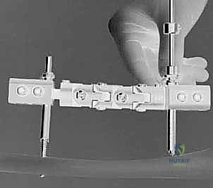 تجميع جهاز التثبيت الخارجي