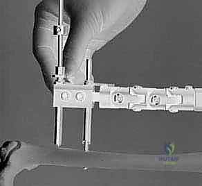 استخدام جهاز الأشعة داخل غرفة العمليات