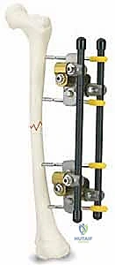 إدخال الدبابيس المعدنية بدقة