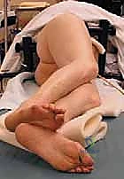 خطوات التشخيص الدقيق لعدوى المفاصل