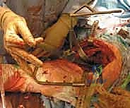 تحاليل الدم والمؤشرات قبل المرحلة الثانية