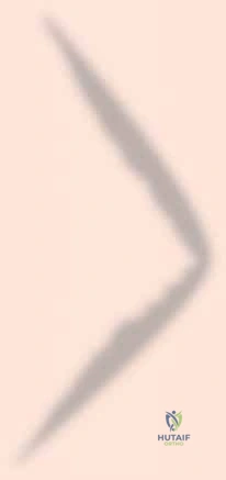 صورة طبية: كسر الرضفة: دليل شامل لعملية التثبيت الداخلي بالأسلاك (ORIF) مع الأستاذ الدكتور محمد هطيف