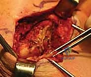 الأستاذ الدكتور محمد هطيف أثناء إجراء عملية دقيقة