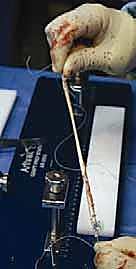 حفر الأنفاق العظمية بدقة