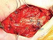 تجهيزات غرفة العمليات الحديثة