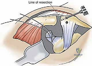 تقييم الخيارات الجراحية
