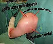 تمارين تقوية عضلات الكتف