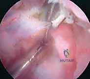 استخدام الأشعة السينية المتخصصة في التشخيص