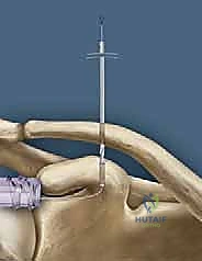 تمارين استعادة المدى الحركي