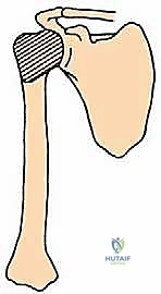 عزل وحماية العصب الكعبري أثناء الجراحة