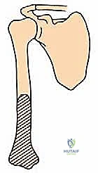 أشعة مقطعية ثلاثية الأبعاد للتخطيط