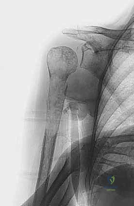 صورة توضح التخطيط الجراحي الدقيق