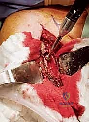 تجهيز وضعية المريض