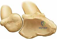 الأشعة السينية للرسغ