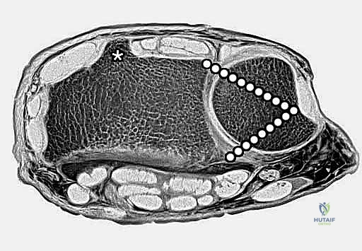 تشريح مفصل الرسغ